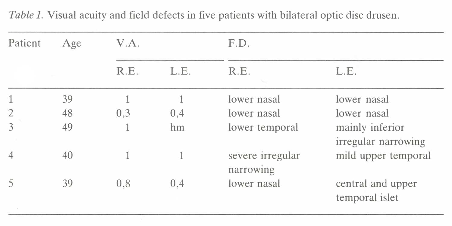 Visual acuity and field defects in five patients with bilateral optic disc drusen