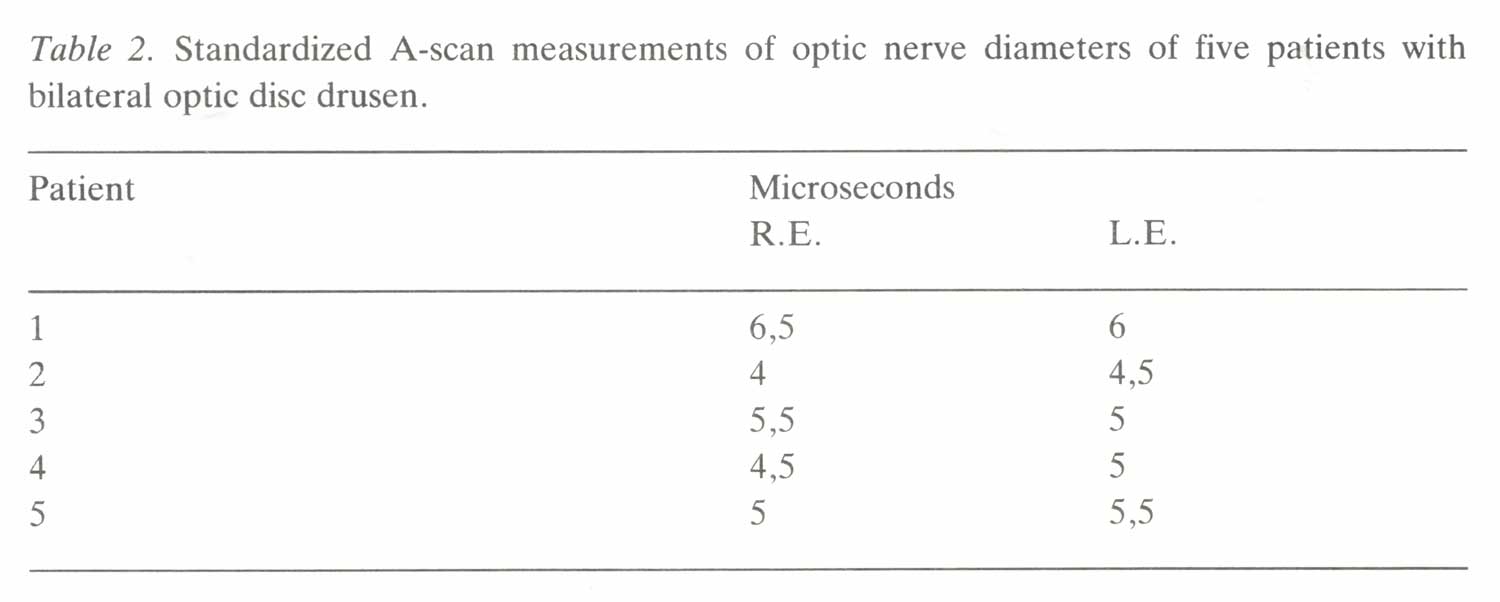 Standardized A-scan measurements of optic nerve diameters of five patients with bilateral optica disc drusen